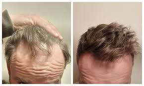 Product used